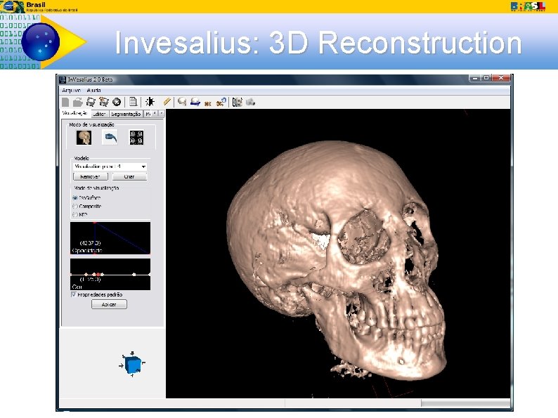 Invesalius: 3 D Reconstruction 