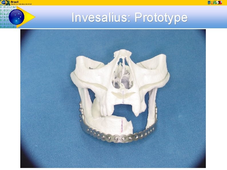 Invesalius: Prototype 