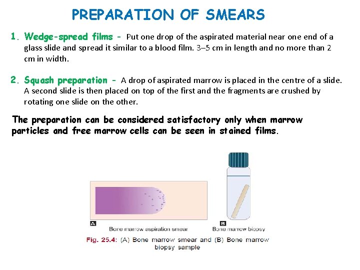 PREPARATION OF SMEARS 1. Wedge-spread films - Put one drop of the aspirated material