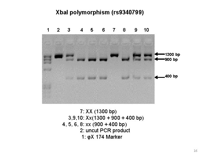 Xba. I polymorphism (rs 9340799) 1 2 3 4 5 6 7 8 9