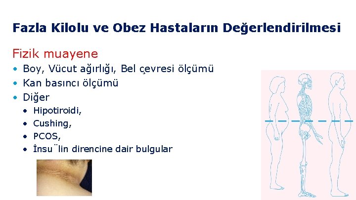 Fazla Kilolu ve Obez Hastaların Değerlendirilmesi Fizik muayene • Boy, Vücut ağırlığı, Bel c