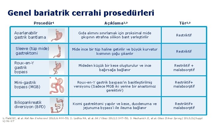 Genel bariatrik cerrahi prosedürleri Prosedür 1 Ayarlanabilir gastrik bantlama Açıklama 2, 3 Tür 2,