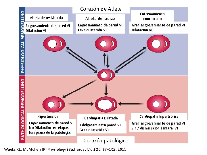 Corazón de Atleta de resistencia Atleta de fuerza Entrenamiento combinado Engrosamiento de pared VI