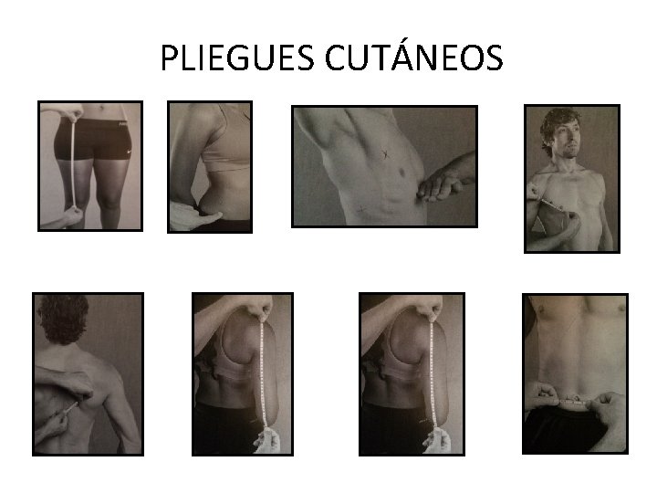 PLIEGUES CUTÁNEOS 
