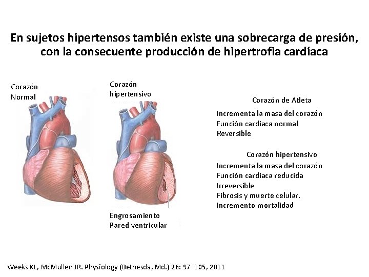 En sujetos hipertensos también existe una sobrecarga de presión, con la consecuente producción de