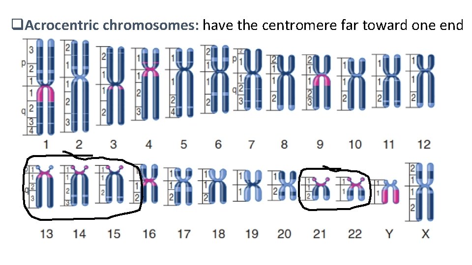 q. Acrocentric chromosomes: have the centromere far toward one end 
