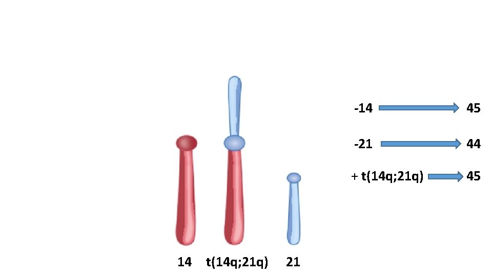 45, XY, – 14, – 21, +t(14 q; 21 q) 14 t(14 q; 21