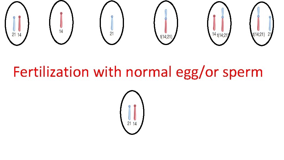 Fertilization with normal egg/or sperm 