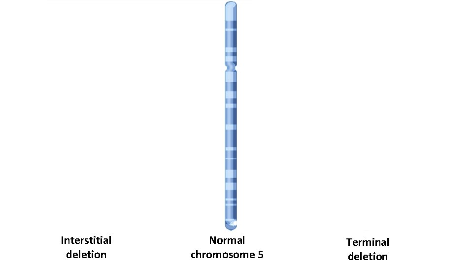 Interstitial deletion Normal chromosome 5 Terminal deletion 