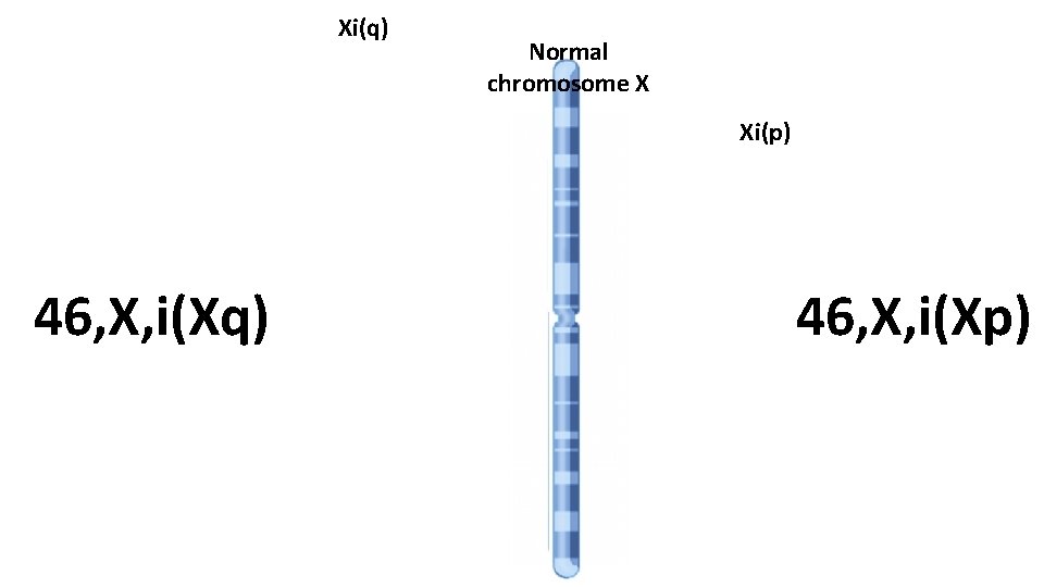 Xi(q) Normal chromosome X Xi(p) 46, X, i(Xq) 46, X, i(Xp) 