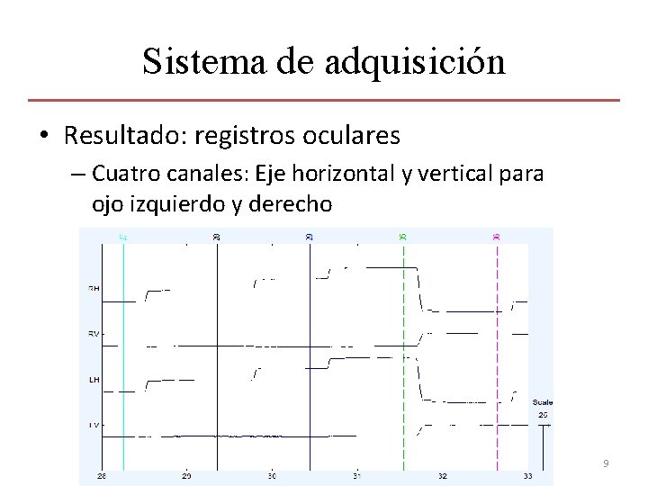Sistema de adquisición • Resultado: registros oculares – Cuatro canales: Eje horizontal y vertical