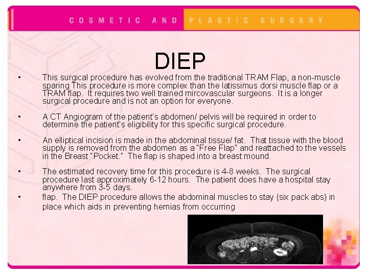 DIEP • This surgical procedure has evolved from the traditional TRAM Flap, a non-muscle