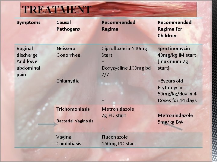 TREATMENT Symptoms Causal Pathogens Recommended Regime for Children Vaginal discharge And lower abdominal pain