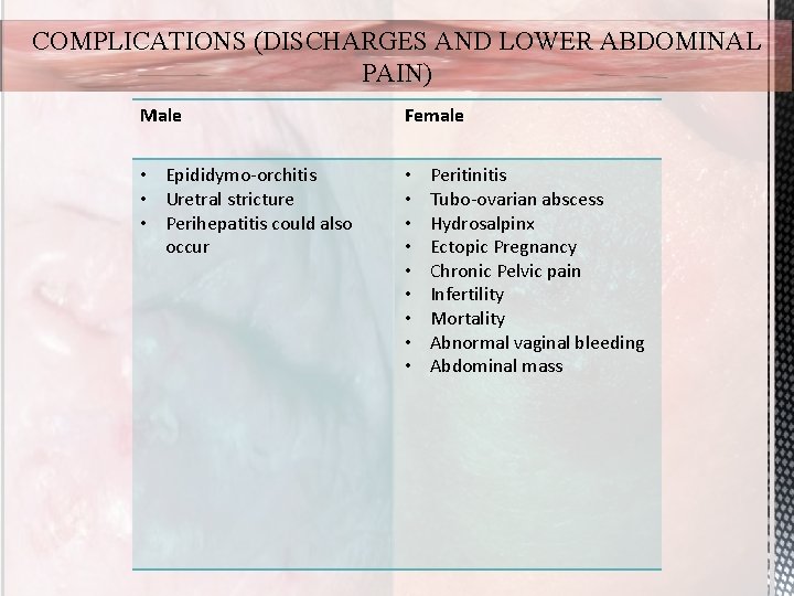 COMPLICATIONS (DISCHARGES AND LOWER ABDOMINAL PAIN) Male Female • Epididymo-orchitis • Uretral stricture •