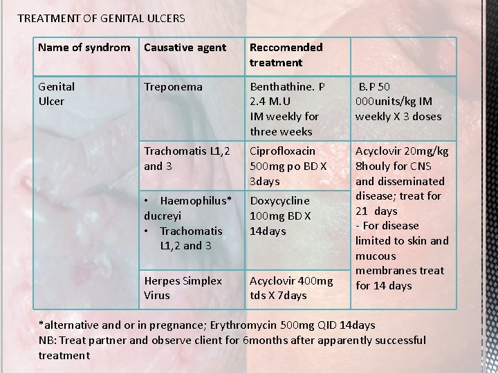 TREATMENT OF GENITAL ULCERS Name of syndrom Causative agent Reccomended treatment Genital Ulcer Treponema