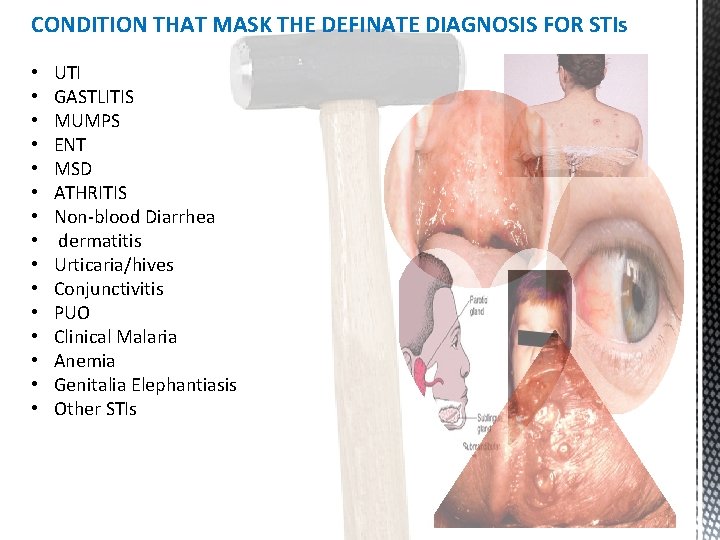 CONDITION THAT MASK THE DEFINATE DIAGNOSIS FOR STIs • • • • UTI GASTLITIS