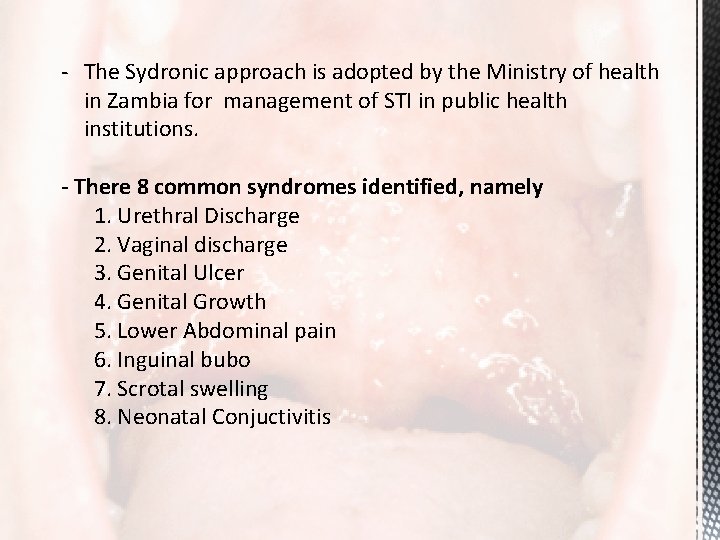 - The Sydronic approach is adopted by the Ministry of health in Zambia for