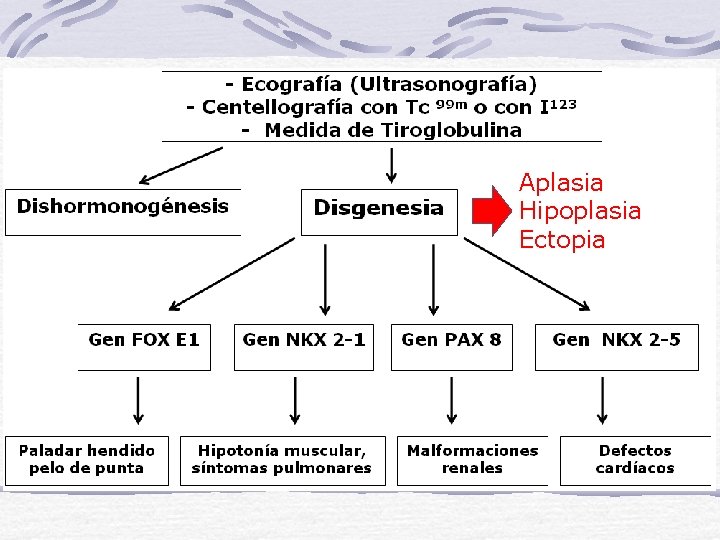 Aplasia Hipoplasia Ectopia 