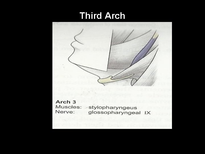 Third Arch 