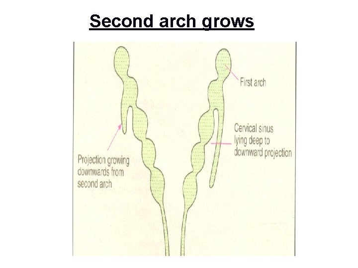 Second arch grows 