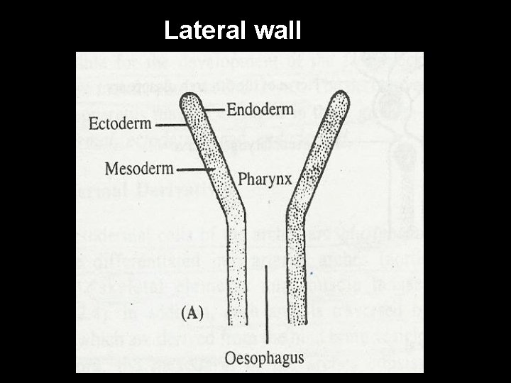 Lateral wall 