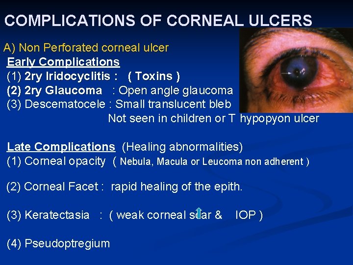 COMPLICATIONS OF CORNEAL ULCERS A) Non Perforated corneal ulcer Early Complications (1) 2 ry