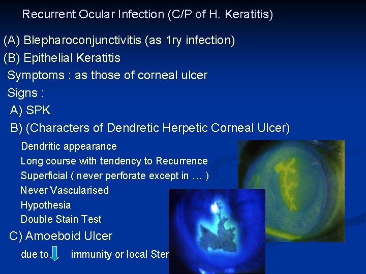 Recurrent Ocular Infection (C/P of H. Keratitis) (A) Blepharoconjunctivitis (as 1 ry infection) (B)