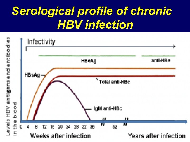 Serological profile of chronic HBV infection 