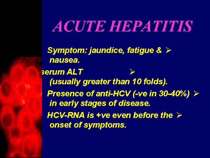 ACUTE HEPATITIS Symptom: jaundice, fatigue & Ø nausea. Elevated serum ALT Ø (usually greater