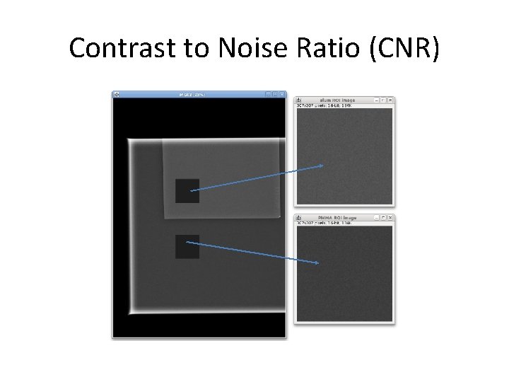 Contrast to Noise Ratio (CNR) 