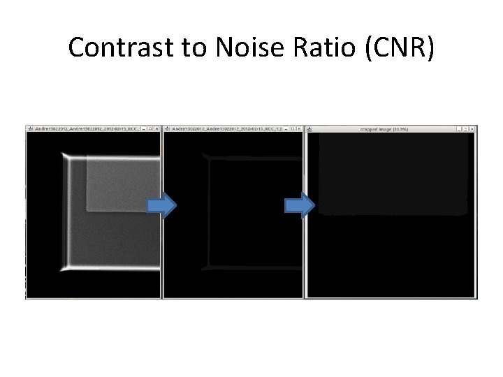 Contrast to Noise Ratio (CNR) 