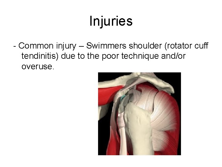 Injuries - Common injury – Swimmers shoulder (rotator cuff tendinitis) due to the poor