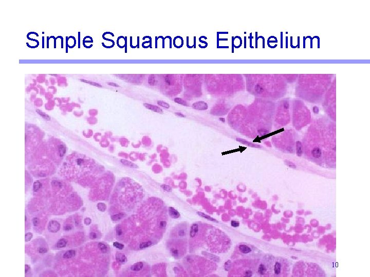 Simple Squamous Epithelium 10 