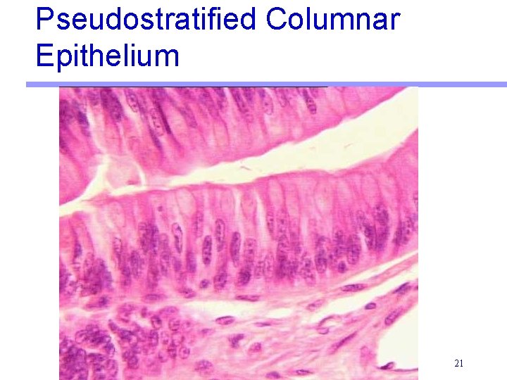 Pseudostratified Columnar Epithelium 21 