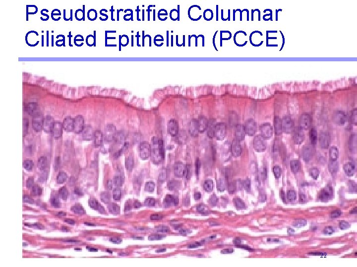 Pseudostratified Columnar Ciliated Epithelium (PCCE) 22 