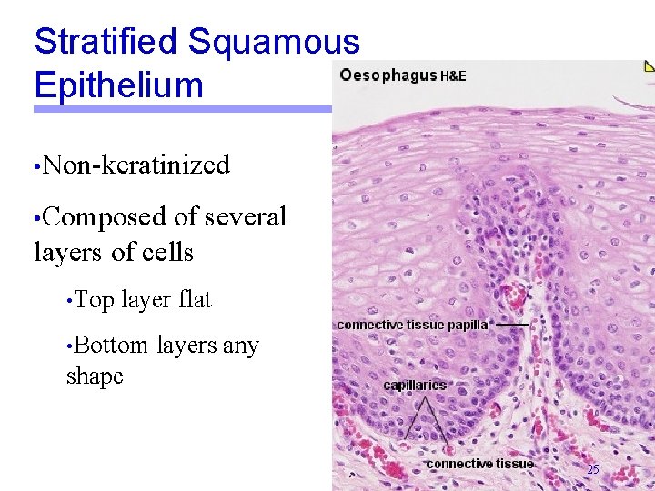Stratified Squamous Epithelium • Non-keratinized • Composed of several layers of cells • Top