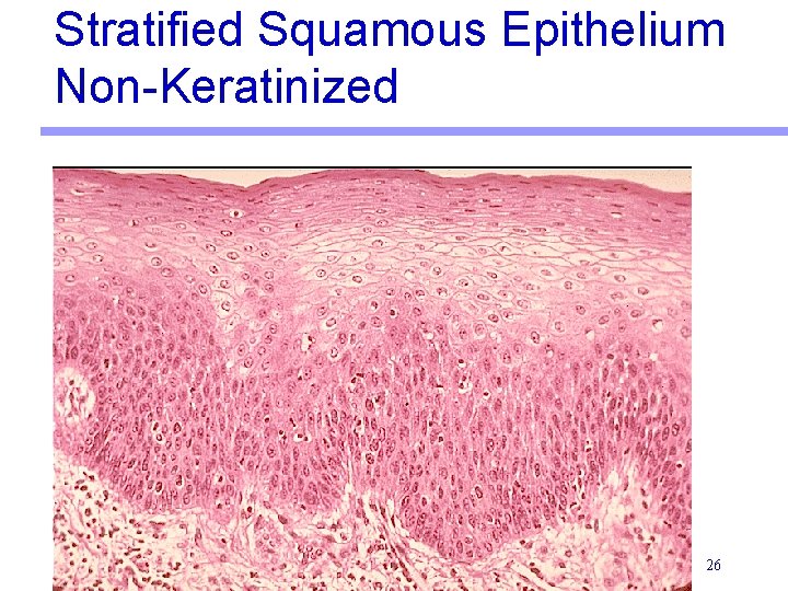 Stratified Squamous Epithelium Non-Keratinized 26 