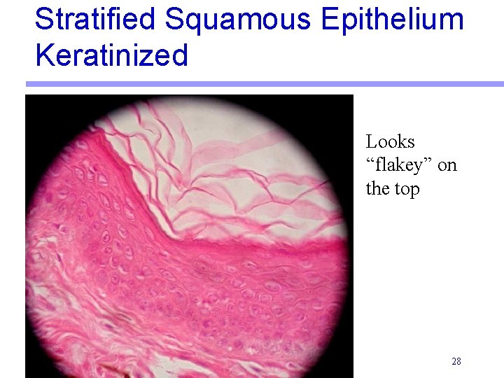 Stratified Squamous Epithelium Keratinized Looks “flakey” on the top 28 