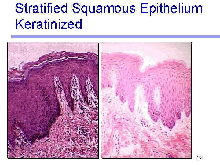 Stratified Squamous Epithelium Keratinized 29 