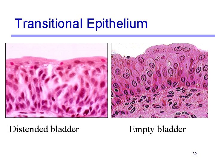 Transitional Epithelium Distended bladder Empty bladder 32 