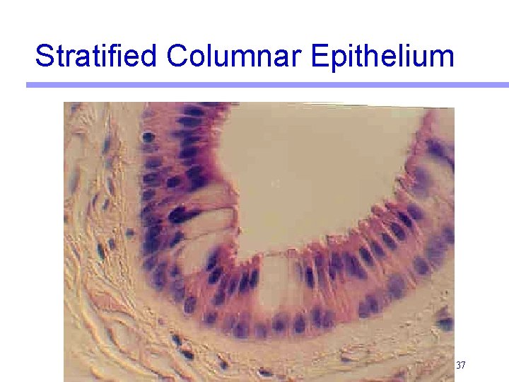 Stratified Columnar Epithelium 37 