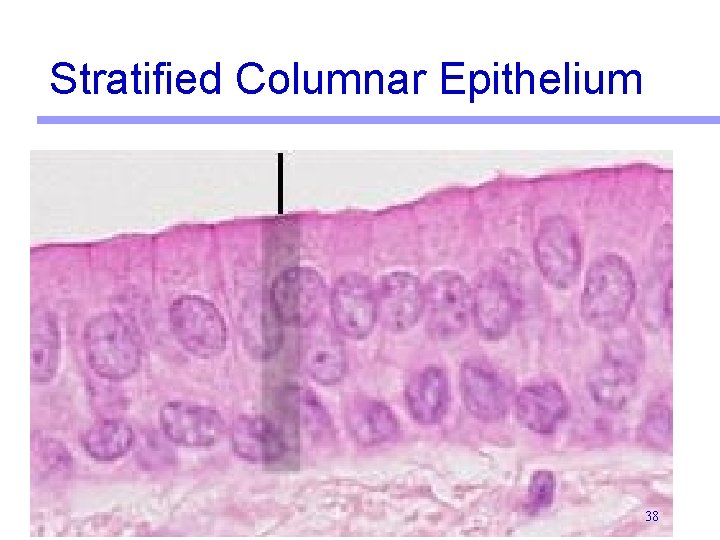 Stratified Columnar Epithelium 38 