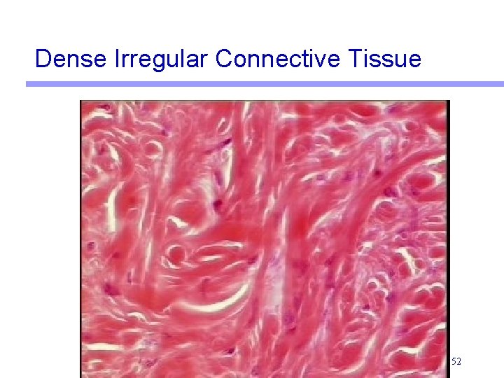 Dense Irregular Connective Tissue 52 