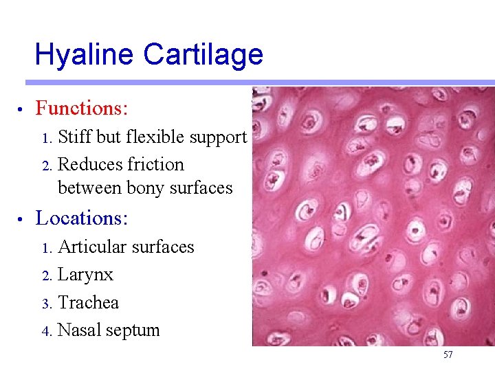 Hyaline Cartilage • Functions: 1. Stiff but flexible support 2. Reduces friction between bony