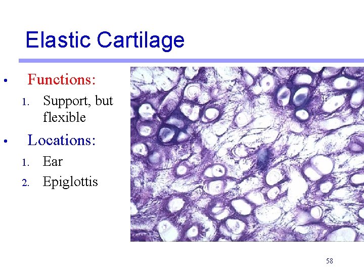 Elastic Cartilage • Functions: 1. • Support, but flexible Locations: 1. 2. Ear Epiglottis