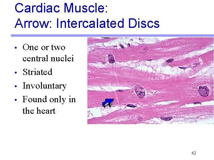 Cardiac Muscle: Arrow: Intercalated Discs • • One or two central nuclei Striated Involuntary