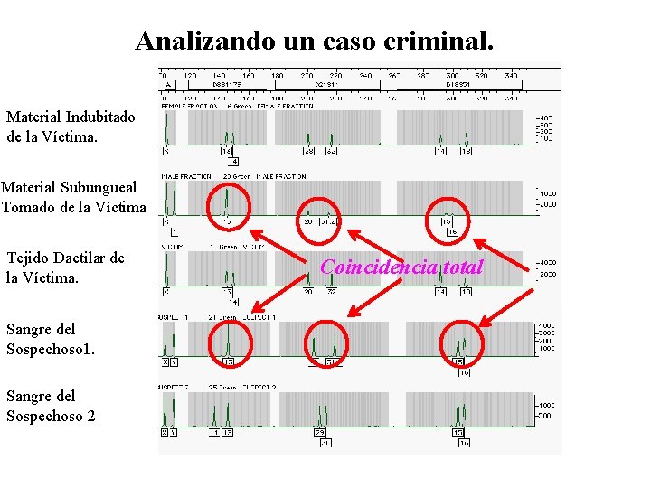 Analizando un caso criminal. Material Indubitado de la Víctima. Material Subungueal Tomado de la