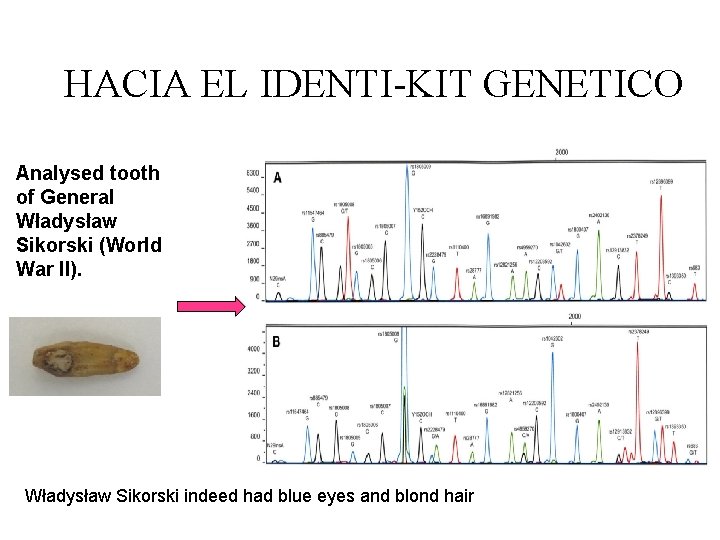 HACIA EL IDENTI-KIT GENETICO Analysed tooth of General Władysław Sikorski (World War II). Władysław