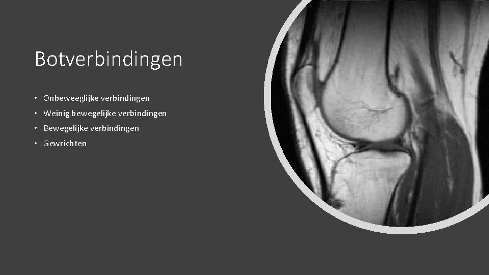 Botverbindingen • Onbeweeglijke verbindingen • Weinig bewegelijke verbindingen • Bewegelijke verbindingen • Gewrichten 