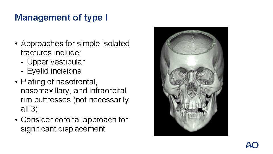 Management of type I • Approaches for simple isolated fractures include: - Upper vestibular